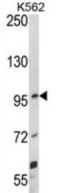 Netrin Receptor UNC5C (UNC5C) Antibody
