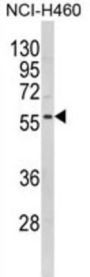 Potassium Voltage-Gated Channel Subfamily J Member 2 (KCNJ2) Antibody