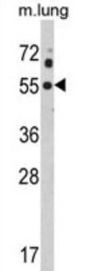 Potassium Voltage-Gated Channel Subfamily J Member 2 (KCNJ2) Antibody
