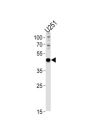 Paired Box Protein Pax-6 (PAX6) Antibody