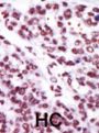 Protein Kinase C Epsilon Type (PRKCE) Antibody