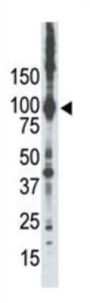 Protein Kinase C Epsilon Type (PRKCE) Antibody
