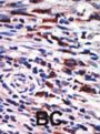 PKC eta Antibody