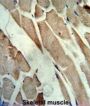 CKM Antibody
