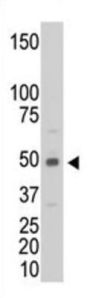 CKM Antibody