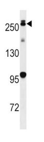 Leucine-Rich Repeat Serine/threonine-Protein Kinase 2 (PARK8) Antibody
