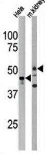 PSKH1 Antibody