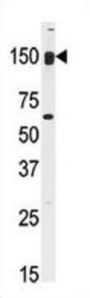 CLASP2 Antibody