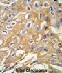 Receptor Interacting Serine Threonine Kinase 3 (RIPK3) Antibody