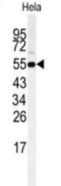 Receptor Interacting Serine Threonine Kinase 3 (RIPK3) Antibody