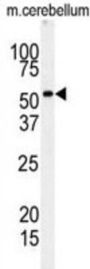Receptor Interacting Serine Threonine Kinase 3 (RIPK3) Antibody