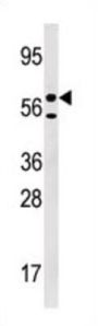 Uridine-Cytidine Kinase-Like 1 (URKL1) Antibody