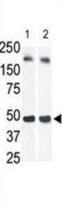 Sphingosine Kinase 1 (SPHK1) Antibody