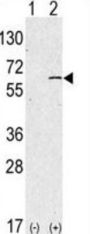Sphingosine Kinase 1 (SPHK1) Antibody