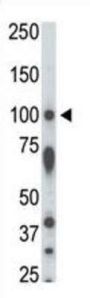 Serine/Threonine Kinase 31 (STK31) Antibody