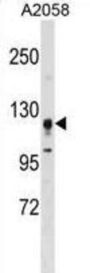 Serine/Threonine Kinase 31 (STK31) Antibody