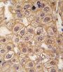 Beta-2 Adrenergic Receptor (ADRB2) Antibody