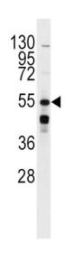 Beta-2 Adrenergic Receptor (ADRB2) Antibody