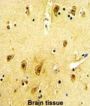 Beta-2 Adrenergic Receptor (ADRB2) Antibody