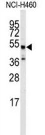 Beta-2 Adrenergic Receptor (ADRB2) Antibody