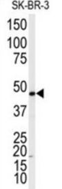 Beta-2 Adrenergic Receptor (ADRB2) Antibody