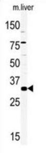 Homeobox Protein HMX2 (HMX2) Antibody