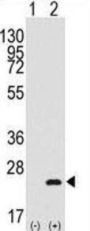 Homeobox Protein BarH-Like 1 (BARX1) Antibody