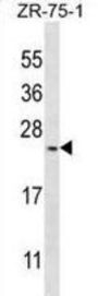 Homeobox Protein BarH-Like 1 (BARX1) Antibody