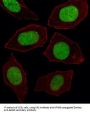 Homeobox Protein Engrailed-1 (EN1) Antibody