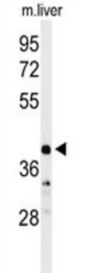 Carbonic Anhydrase VB, Mitochondrial (CA5B) Antibody