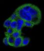 Fibrinogen Gamma (FGG) Antibody
