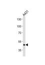 Fibrinogen Gamma (FGG) Antibody
