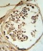 LYAR Antibody