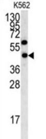 LYAR Antibody