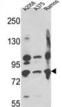 Neprilysin / NEP (MME) Antibody