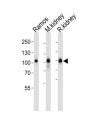 Neprilysin / NEP (MME) Antibody