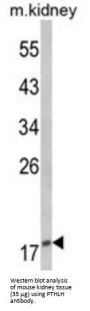 Parathyroid Hormone-Related Protein / PTHrP (PTHLH) Antibody