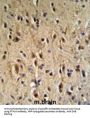 Parathyroid Hormone-Related Protein / PTHrP (PTHLH) Antibody