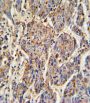 CATB Antibody
