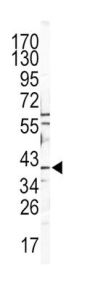 CATB Antibody