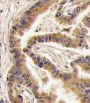 Casein Kinase I Isoform Alpha (CSNK1A1) Antibody
