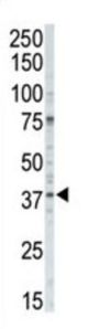 Casein Kinase I Isoform Alpha (CSNK1A1) Antibody
