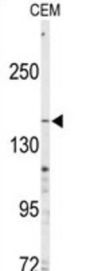 Multidrug Resistance-Associated Protein 4 (ABCC4) Antibody