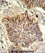 Golgi Phosphoprotein 3 (GOLPH3) Antibody