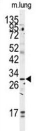 Golgi Phosphoprotein 3 (GOLPH3) Antibody