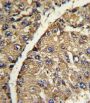Vitronectin (VTN) Antibody