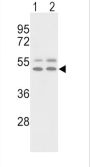 Vitronectin (VTN) Antibody