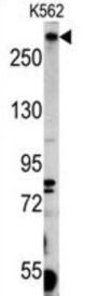 Pericentriolar Material 1 Protein (PCM-1) Antibody