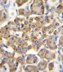 Gastric Inhibitory Polypeptide Receptor (GIPR) Antibody