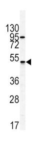 Gastric Inhibitory Polypeptide Receptor (GIPR) Antibody